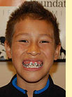 Bernstein Orthodontics